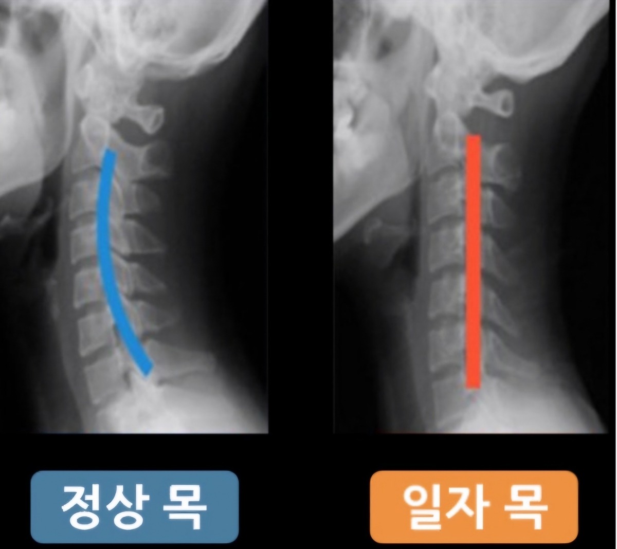 [예술가를 위한 건강정보] 예술가의 목 건강 이렇게 지키자